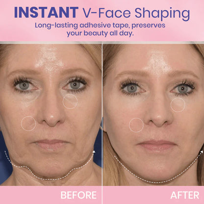 Faugettt™ V-Face Lifting Adhesive Tape