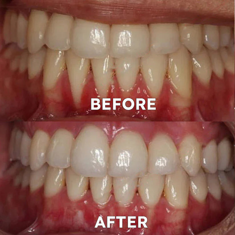 Ourlyard™ Tooth Powder